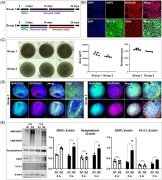 알츠하이머 환자 유래 크기와 조성이 균일한 신경 및 성상세포 3차원 스페로이드, 이의 제조 방법, 및 이를 이용한 약물 스크리닝 방법 및 키트 대표도면